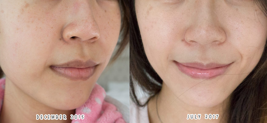 Skin changes